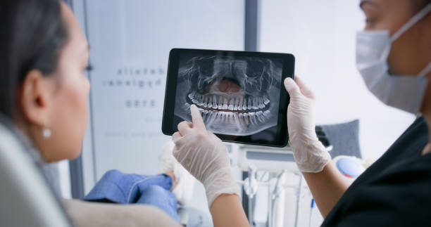Licensed Tooth Extraction service in Columbus, OH - Smile Center Dentistry
